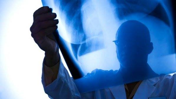 Leia mais sobre o artigo Radiologistas suspendem atendimentos da Unimed Caruaru