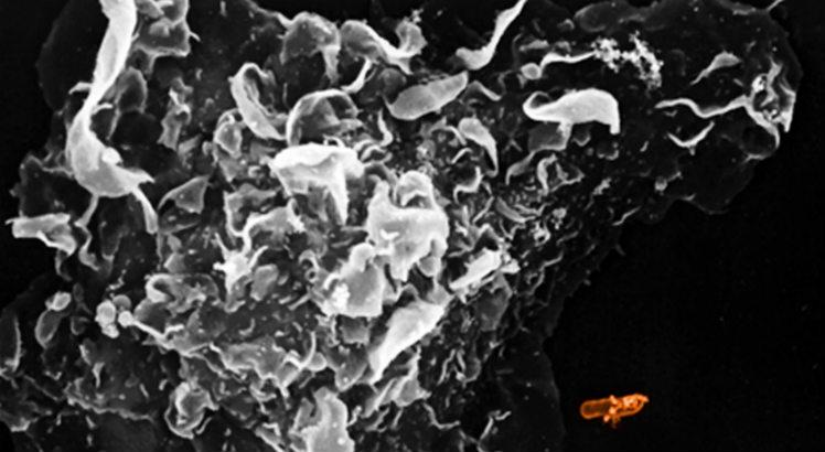 Leia mais sobre o artigo Estudo ajuda a entender como as células de defesa combatem bactérias