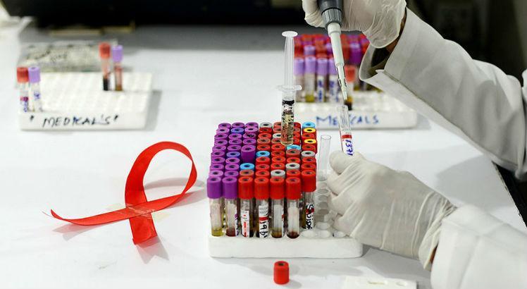 Leia mais sobre o artigo Soropositivos com carga viral indetectável não transmitem HIV