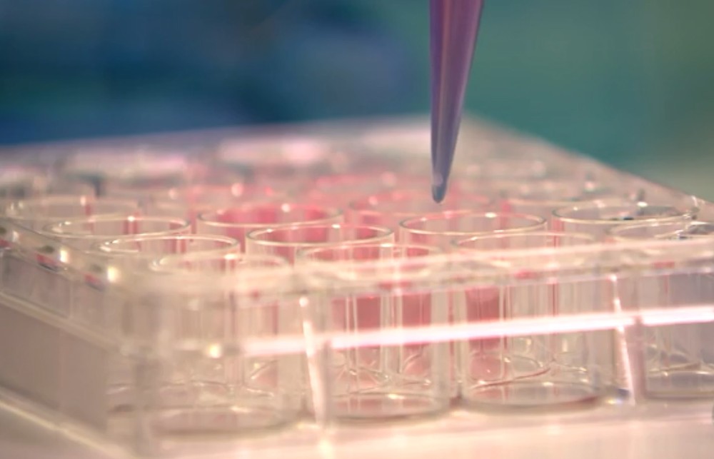 Leia mais sobre o artigo Pesquisa comprova que vírus da Zika mata células cancerígenas do cérebro