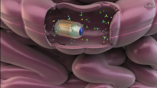 Leia mais sobre o artigo A pílula que analisa as flatulências e detecta problemas no sistema digestivo