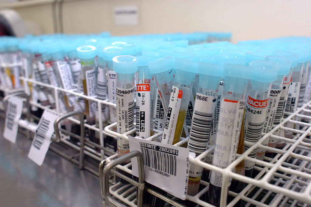 Leia mais sobre o artigo OMS recomenda aumentar oferta de testes e tratamento para tuberculose