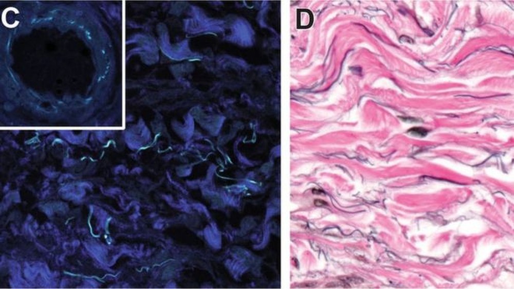 Leia mais sobre o artigo Interstício, o ‘novo órgão’ do corpo humano que a ciência acaba de descobrir