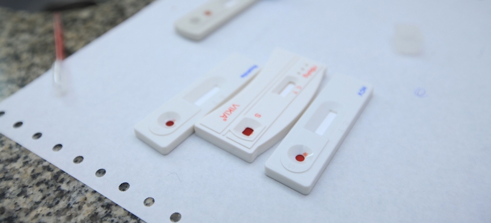 Leia mais sobre o artigo Pesquisa vai comparar efeitos de medicamentos para HIV