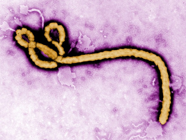 Leia mais sobre o artigo Cientistas quenianos garantem ter descoberto 2 vacinas contra o ebola