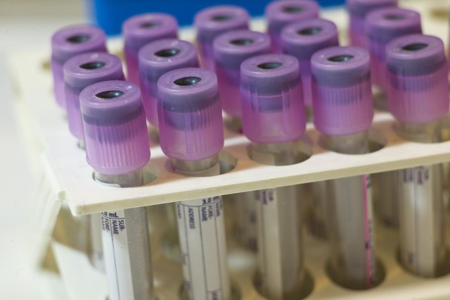 Leia mais sobre o artigo Estudo usa amostra de sangue para detectar autismo em crianças