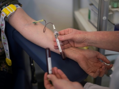 Leia mais sobre o artigo Exame de sangue pode prever parto prematuro