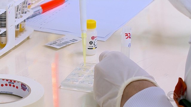 Leia mais sobre o artigo Toxoplasmose: entenda os sintomas e como se prevenir