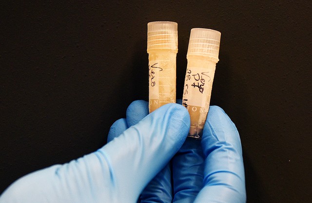 Leia mais sobre o artigo Unicamp desenvolve protótipo de vacina de proteção dupla contra vírus da zika e meningite