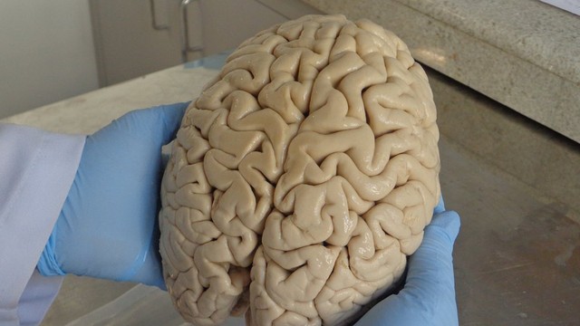 Leia mais sobre o artigo Como cérebros doados no Brasil estão ajudando a descobrir origem do Mal de Alzheimer