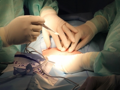 Leia mais sobre o artigo 33 mil pessoas aguardam por transplante de órgãos no País