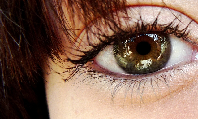 Leia mais sobre o artigo Chance de catarata aumenta na menopausa, diz especialista