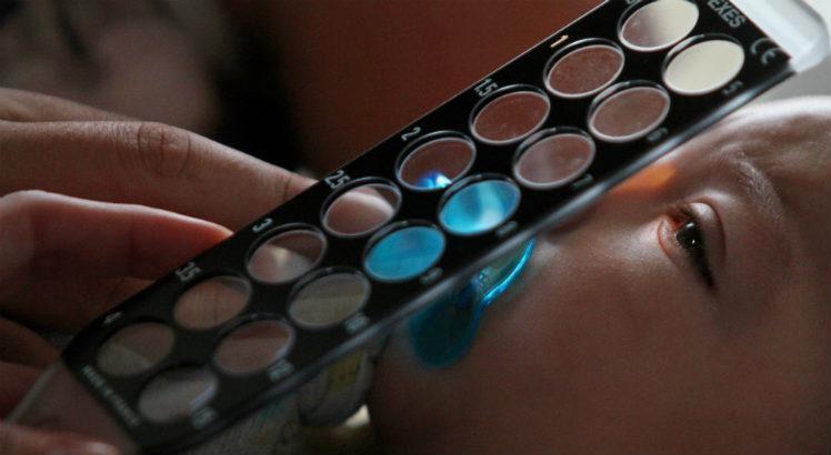 Leia mais sobre o artigo Microcefalia por zika: desafios ainda precisam ser vencidos três anos após primeira epidemia