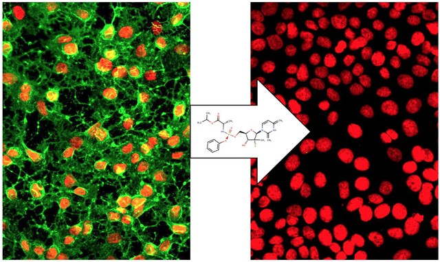 Leia mais sobre o artigo Remédio contra a hepatite C é eficiente no combate à chikungunya em células humanas, dizem cientistas brasileiros