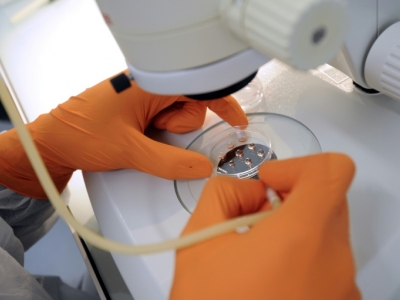 Leia mais sobre o artigo Técnica pode criar rins humanos para transplante