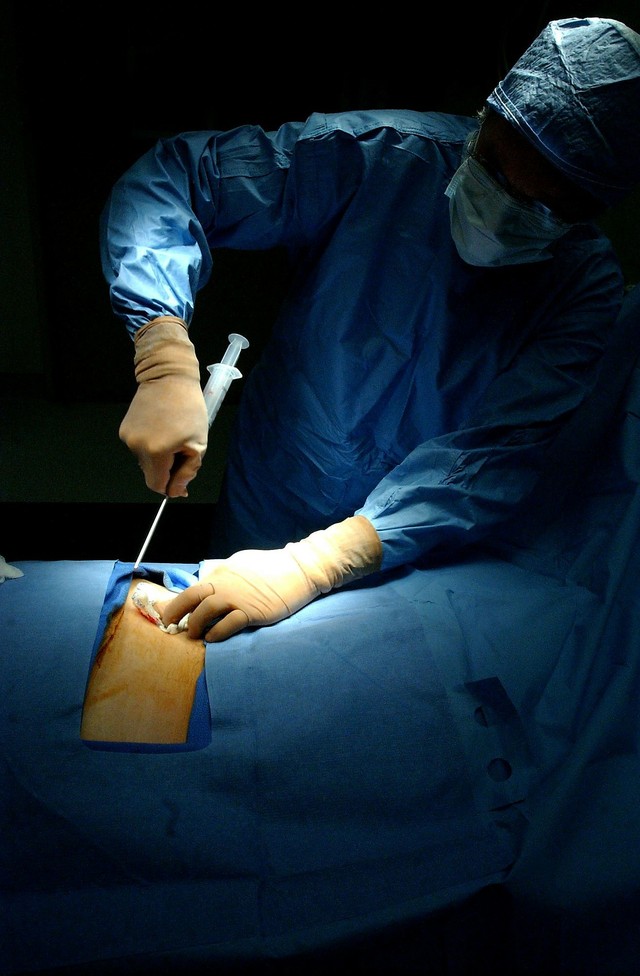 Leia mais sobre o artigo Novo material pode substituir transplante de medula óssea, diz estudo