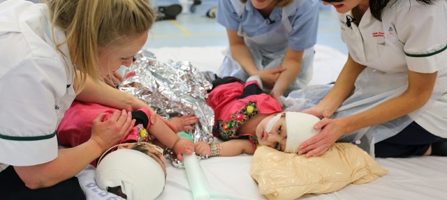 Leia mais sobre o artigo Gêmeas unidas pelo crânio são separadas depois de 50 horas de cirurgia