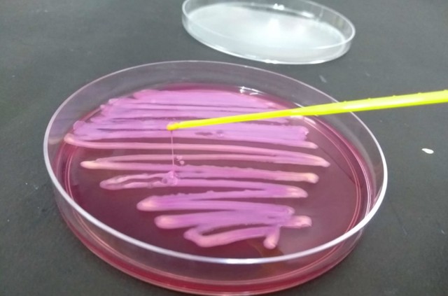Leia mais sobre o artigo Pesquisa alerta para circulação de superbactérias fora do hospital e uso indiscriminado de antibióticos