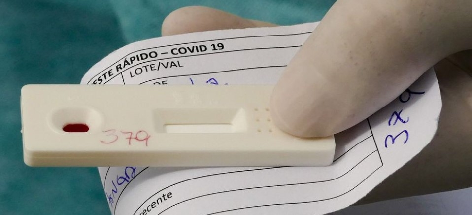 Leia mais sobre o artigo Saiba como fazer o teste de Covid-19 pelo plano de saúde