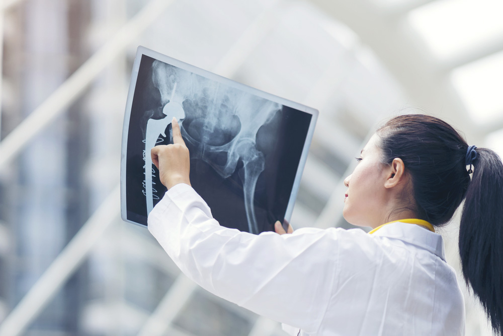 Leia mais sobre o artigo SINMED-AL: Estado protela regularização da oferta de cirurgia ortopédica