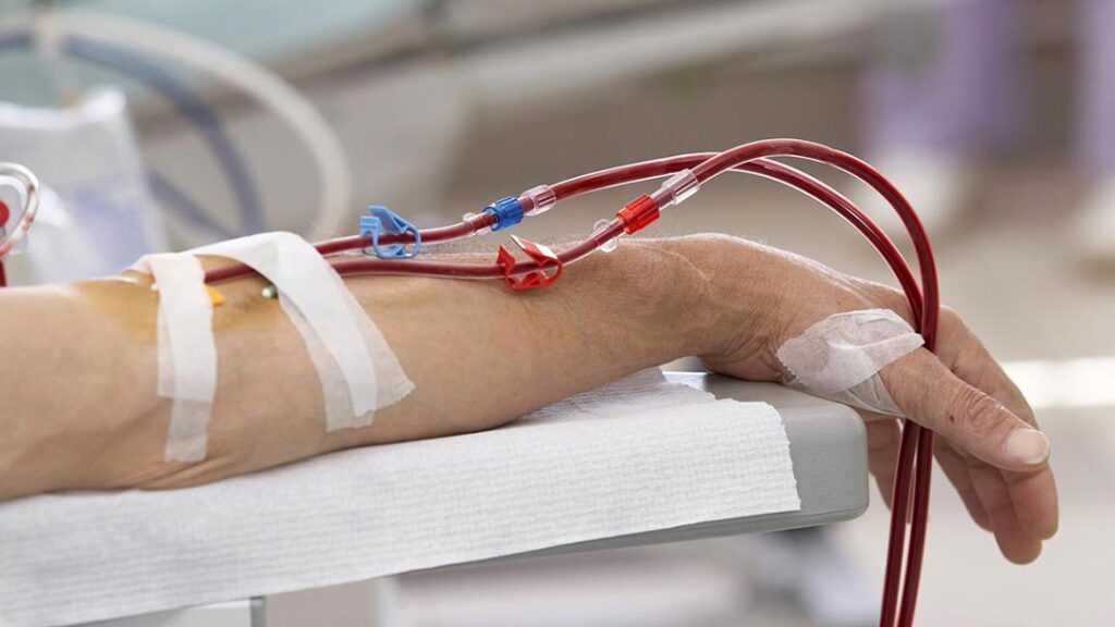 Leia mais sobre o artigo Médicos do HAM reclamam dos graves problemas enfrentados pelos pacientes em hemodiálise