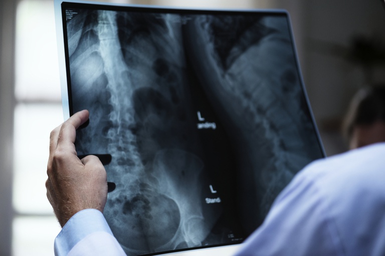Leia mais sobre o artigo CEHM-PE e médicos traumato-ortopedistas manifestatam insatisfação com o descaso da AMIL e CAMED/UNIDAS
